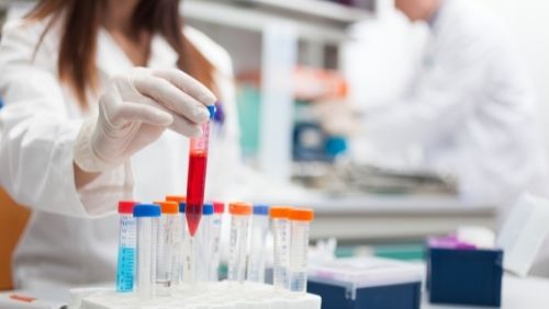 Image of a researcher conducting a blood test.