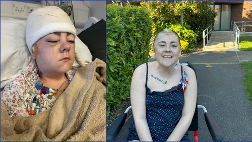 Katie in recovery post surgery